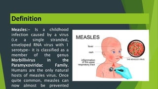 Definition
Measles:- Is a childhood
infection caused by a virus
(i.e a single stranded,
enveloped RNA virus with 1
serotyp...