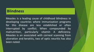Conclusion
Measles infections can harm the front and even
down to the back of the eye and possibly causing
vision loss or ...