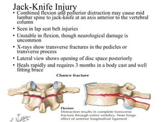 Jack-Knife Injury
• Combined flexion and posterior distraction may cause mid
lumbar spine to jack-knife at an axis anterior to the vertebral
column
• Seen in lap seat belt injuries
• Unstable in flexion, though neurological damage is
uncommon
• X-rays show transverse fractures in the pedicles or
transverse process
• Lateral view shows opening of disc space posteriorly
• Heals rapidly and requires 3 months in a body cast and well
fitting brace
 