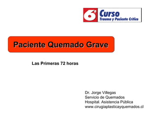 Dr. Jorge Villegas Servicio de Quemados Hospital. Asistencia Pública www.cirugiaplasticayquemados.cl Las Primeras 72 horas Paciente Quemado Grave 