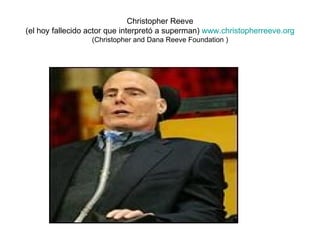 Christopher Reeve (el hoy fallecido actor que interpretó a superman)  www.christopherreeve.org   (Christopher and Dana Reeve Foundation ) 