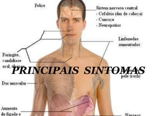 PRINCIPAIS SINTOMAS

 