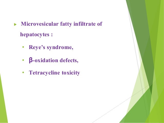 ïµ Microvesicular fatty infiltrate of
hepatocytes :
â¢ Reyeâs syndrome,
â¢ Î²-oxidation defects,
â¢ Tetracycline toxicity
 