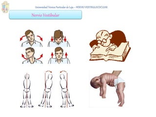 Nervio Vestibular
 