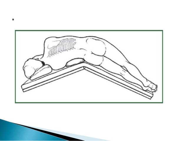 Video Assisted Thoracic Surgery vats 