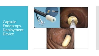 Capsule
Endoscopy
Deployment
Device
 