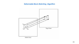 254
Deformable Block Matching Algorithm
 