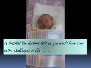 In hospital the doctors told us you would have some extra challenges in life……..