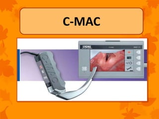 Videolaryngoscopes for tracheal intubation | PPTX