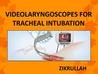 VIDEOLARYNGOSCOPES FOR
TRACHEAL INTUBATION
ZIKRULLAH
 