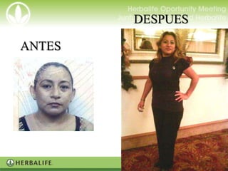 DESPUES

ANTES
  ANTES
 