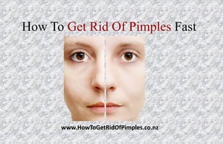 How To Get Rid Of Pimples Fast




      www.HowToGetRidOfPimples.co.nz
 
