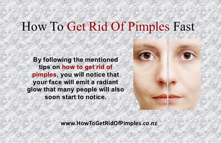 How To Get Rid Of Pimples In One Day Naturally How To Get Rid Of Pimples In One Day Naturally