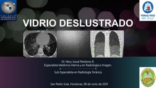 VIDRIO DESLUSTRADO
Dr. Nery Josué Perdomo R.
Especialista Medicina interna y en Radiología e Imagen.
Sub Especialista en Radiología Torácica
San Pedro Sula, Honduras, 08 de Junio de 2021
 