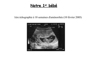 Notre 1 er  bébé 1ère échographie à 10 semaines d'aménorrhée (10 février 2005)  