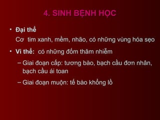 4. SINH BỆNH HỌC4. SINH BỆNH HỌC
• Đại thể
Cơ tim xanh, mềm, nhão, có những vùng hóa sẹo
• Vi thể: có những đốm thâm nhiễm
– Giai đoạn cấp: tương bào, bạch cầu đơn nhân,
bạch cầu ái toan
– Giai đoạn muộn: tế bào khổng lồ
 