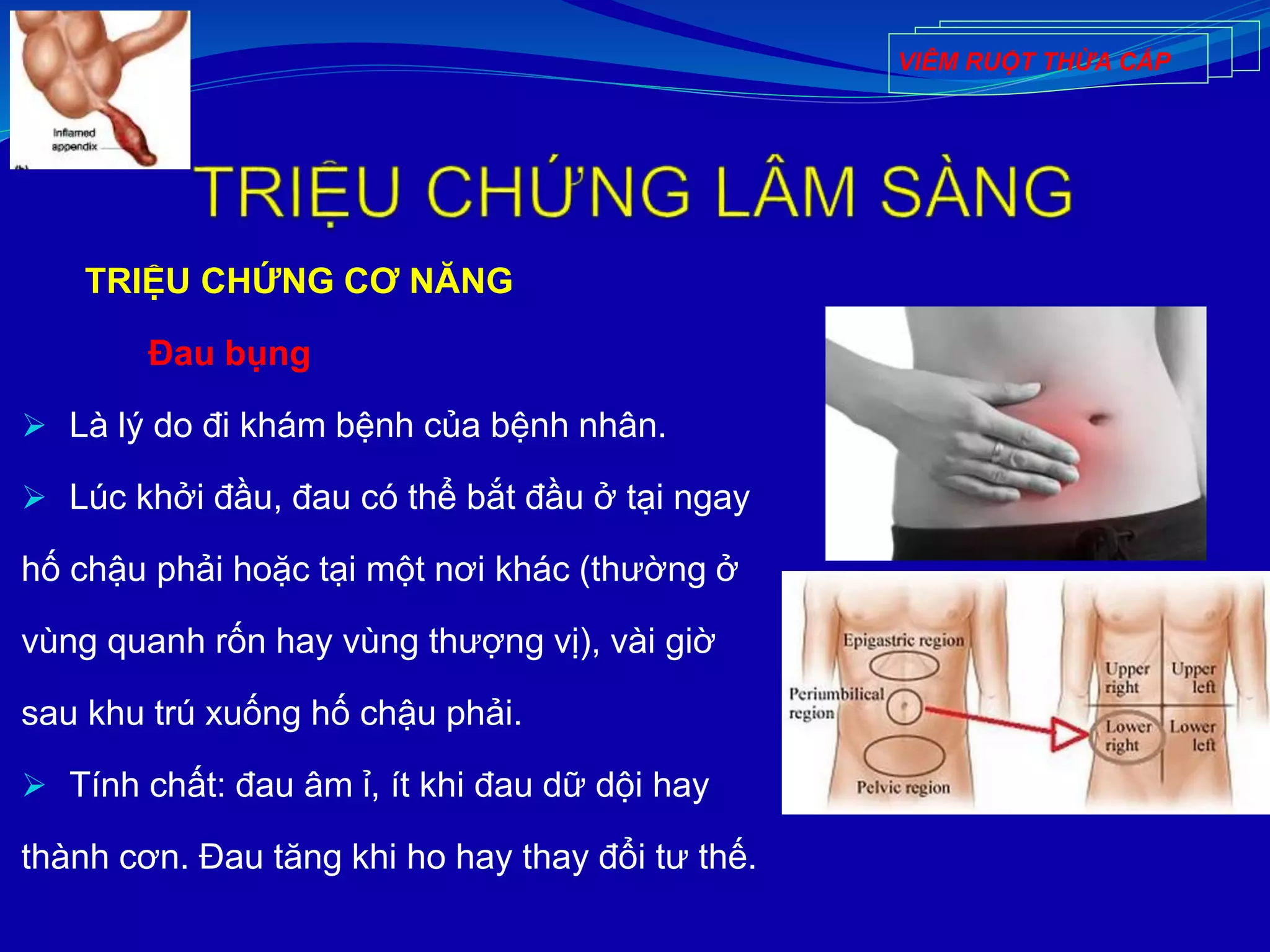 TRIỆU CHỨNG CƠ NĂNG
Đau bụng
 Là lý do đi khám bệnh của bệnh nhân.
 Lúc khởi đầu, đau có thể bắt đầu ở tại ngay
hố chậu phải hoặc tại một nơi khác (thường ở
vùng quanh rốn hay vùng thượng vị), vài giờ
sau khu trú xuống hố chậu phải.
 Tính chất: đau âm ỉ, ít khi đau dữ dội hay
thành cơn. Đau tăng khi ho hay thay đổi tư thế.
VIÊM RUỘT THỪA CẤP
 
