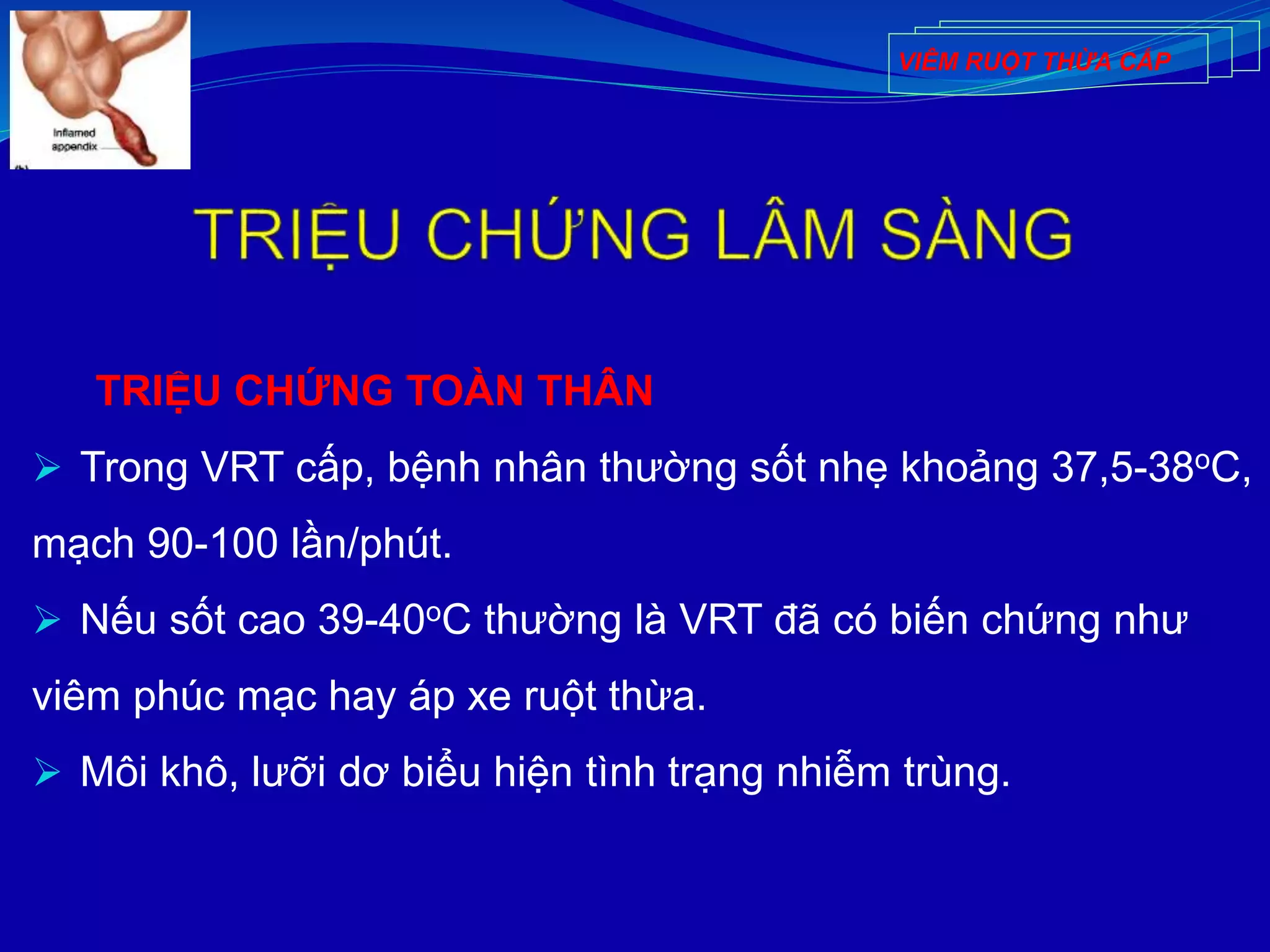 TRIỆU CHỨNG TOÀN THÂN
 Trong VRT cấp, bệnh nhân thường sốt nhẹ khoảng 37,5-38oC,
mạch 90-100 lần/phút.
 Nếu sốt cao 39-40oC thường là VRT đã có biến chứng như
viêm phúc mạc hay áp xe ruột thừa.
 Môi khô, lưỡi dơ biểu hiện tình trạng nhiễm trùng.
VIÊM RUỘT THỪA CẤP
 