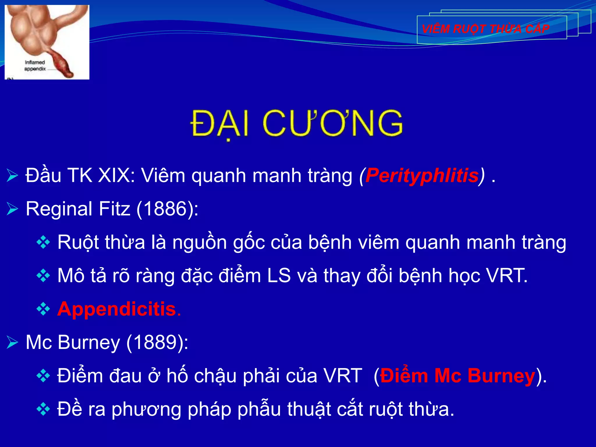  Đầu TK XIX: Viêm quanh manh tràng (Perityphlitis) .
 Reginal Fitz (1886):
 Ruột thừa là nguồn gốc của bệnh viêm quanh manh tràng
 Mô tả rõ ràng đặc điểm LS và thay đổi bệnh học VRT.
 Appendicitis.
 Mc Burney (1889):
 Điểm đau ở hố chậu phải của VRT (Điểm Mc Burney).
 Đề ra phương pháp phẫu thuật cắt ruột thừa.
VIÊM RUỘT THỪA CẤP
 
