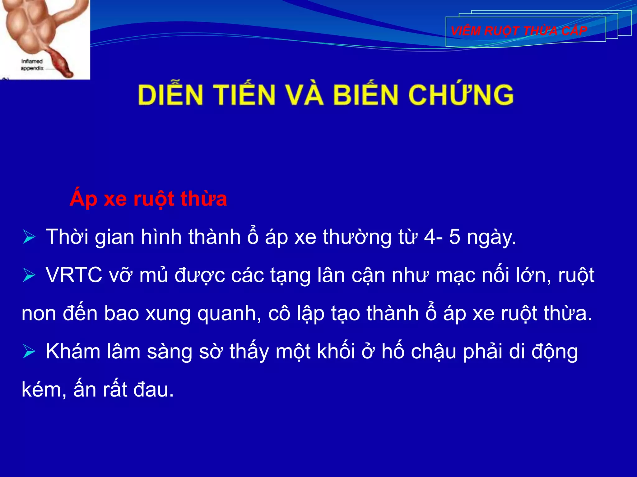Áp xe ruột thừa
 Thời gian hình thành ổ áp xe thường từ 4- 5 ngày.
 VRTC vỡ mủ được các tạng lân cận như mạc nối lớn, ruột
non đến bao xung quanh, cô lập tạo thành ổ áp xe ruột thừa.
 Khám lâm sàng sờ thấy một khối ở hố chậu phải di động
kém, ấn rất đau.
VIÊM RUỘT THỪA CẤP
 