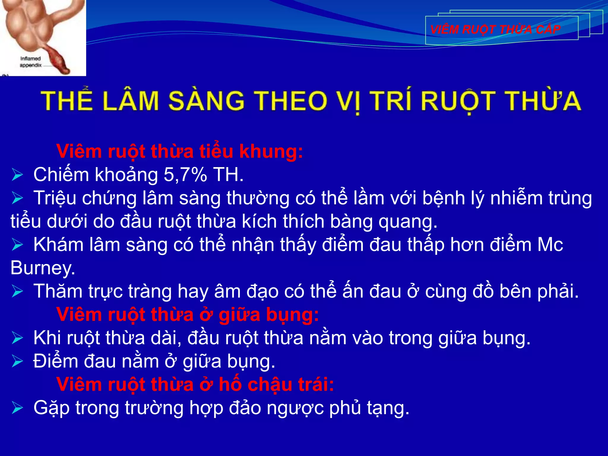 Viêm ruột thừa tiểu khung:
 Chiếm khoảng 5,7% TH.
 Triệu chứng lâm sàng thường có thể lầm với bệnh lý nhiễm trùng
tiểu dưới do đầu ruột thừa kích thích bàng quang.
 Khám lâm sàng có thể nhận thấy điểm đau thấp hơn điểm Mc
Burney.
 Thăm trực tràng hay âm đạo có thể ấn đau ở cùng đồ bên phải.
Viêm ruột thừa ở giữa bụng:
 Khi ruột thừa dài, đầu ruột thừa nằm vào trong giữa bụng.
 Điểm đau nằm ở giữa bụng.
Viêm ruột thừa ở hố chậu trái:
 Gặp trong trường hợp đảo ngược phủ tạng.
VIÊM RUỘT THỪA CẤP
 