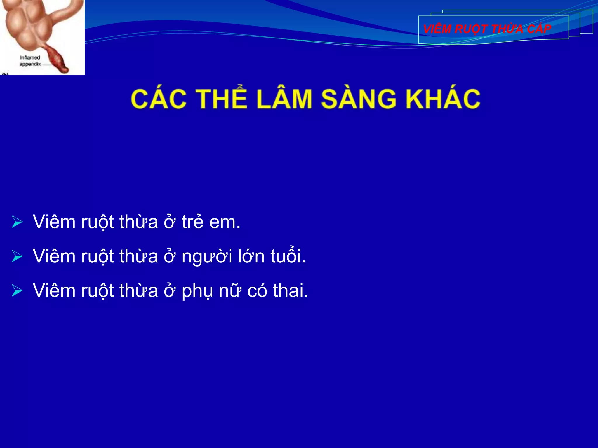  Viêm ruột thừa ở trẻ em.
 Viêm ruột thừa ở người lớn tuổi.
 Viêm ruột thừa ở phụ nữ có thai.
VIÊM RUỘT THỪA CẤP
 