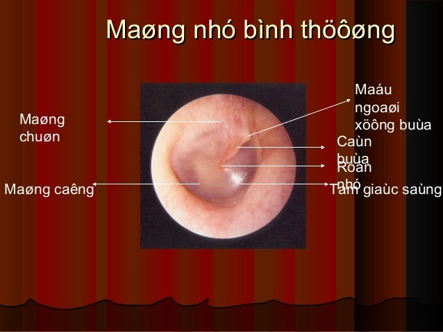 VIÊM TAI GIỮA