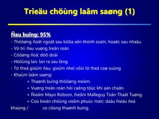 Trieäu chöùng laâm saøng (1)
Ñau buïng: 95%
- Thöôøng ñoät ngoät sau böõa aên thònh soaïn, hoaëc sau nhaäu.
- Vò trí: ñau vuøng treân roán
- Cöôøng ñoä: döõ doäi
- Höôùng lan: lan ra sau löng
- Tö theá giaûm ñau: giaûm nheï vôùi tö theá coø suùng
- Khaùm laâm saøng:
+ Thaønh buïng thöôøng meàm.
+ Vuøng treân roán hôi caêng töùc khi aán chaån.
+ Ñieåm Mayo Robson, ñieåm Malleguy Toân Thaát Tuøng.
+ Coù bieán chöùng vieâm phuùc maïc: daáu hieäu ñeà
khaùng / co cöùng thaønh buïng.
 