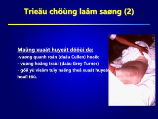 Trieäu chöùng laâm saøng (2)
Maûng xuaát huyeát döôùi da:
-vuøng quanh roán (daáu Cullen) hoaëc
- vuøng hoâng traùi (daáu Grey Turner)
- gôïi yù vieâm tuïy naëng theå xuaát huyeát
hoaïi töû.
 