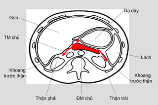 Dạ dày
Gan
Lách
Thận phải
TM chủ
Khoang
trước thận
Thận tráiĐM chủ
Khoang
trước thận
 