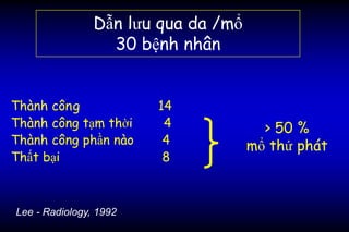 Dẫn lưu qua da /mổ
30 bệnh nhân
Thành công 14
Thành công tạm thời 4
Thành công phần nào 4
Thất bại 8
> 50 %
mổ thứ phát
Lee - Radiology, 1992
 