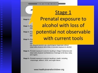 Stage 1
Prenatal exposure to
alcohol with loss of
potential not observable
with current tools
 
