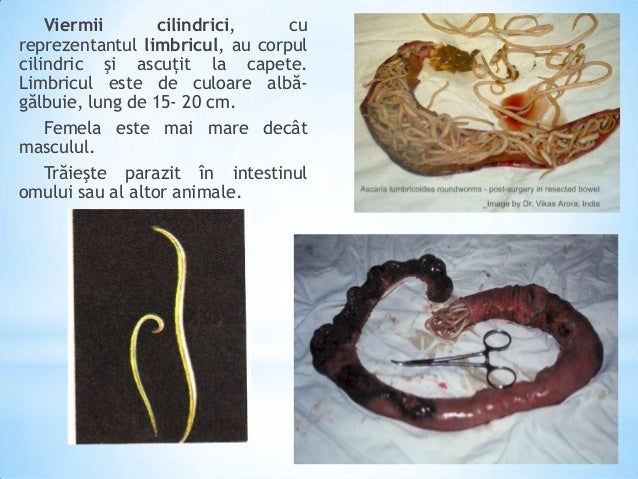 Boli produse de viermii paraziti la om