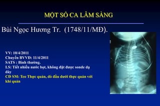 Bùi Ngọc Hương Tr. (1748/11/MĐ).
VV: 10/4/2011
Chuyển BVVĐ: 11/4/2011
SATS : Bình thƣờng.
LS: Tiết nhiều nƣớc bọt, không đặt đƣợc sonde dạ
dày
CĐ SM: Teo Thực quản, dò đầu dƣới thực quản với
khí quản
MỘT SỐ CA LÂM SÀNG
 