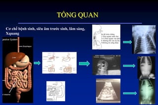 TỔNG QUAN
Cơ chế bệnh sinh, siêu âm trƣớc sinh, lâm sàng,
Xquang
 