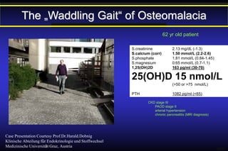The „Waddling Gait“ of Osteomalacia
62 yr old patient
S.creatinine
S.calcium (corr)
S.phosphate
S.magnesium
1,25(OH)2D

2.13 mg/dL (-1.3)
1.50 mmol/L (2.2-2.6)
1.81 mmol/L (0.84-1.45)
0.65 mmol/L (0.7-1.1)
163 pg/ml (30-70)

25(OH)D 15 nmol/L
(>50 or >75 nmol/L)
PTH

1082 pg/ml (<65)
CKD stage III
PAOD stage II
arterial hypertension
chronic pancreatitis (MRI diagnosis)

Case Presentation Courtesy Prof.Dr.Harald.Dobnig
Klinische Abteilung für Endokrinologie und Stoffwechsel
Medizinische Universität Graz, Austria

HD11

 