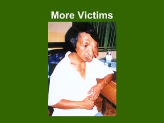 More Victims 