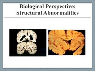 Biological Perspective: Structural Abnormalities 