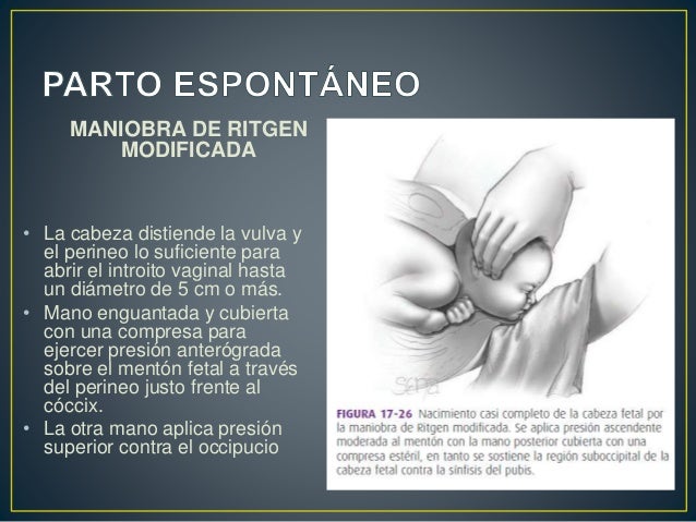 Vigilancia del trabajo de parto