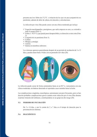 SERIE
DE
RECURSOS
PEDAGÓGICOS
ELABORADOS
POR
LA
ESCUELA
NACIONAL
DE
SALUD
73
presenta una leve fiebre de 37,2°C. e irritación de los ojos sin pus (conjuntivitis no
purulenta), además de dolor de cabeza, de músculos y articulaciones.
La infección por virus Zika puede cursar con una clínica moderada que incluye:
 Erupción maculopapular y pruriginoso, que suele empezar en cara y se extiende a
todo el cuerpo (Foto 1).
 Fiebre (< 38,5º C), que puede pasar desapercibida y su duración es más corta (Foto
2).
 Conjuntivitis no purulenta (Foto 3).
 Cefalea
 Mialgia y artralgia
 Astenia
 Edema en miembros inferiores
Los síntomas aparecen generalmente después de un periodo de incubación de 3 a 12
días y pueden durar hasta 14 días con un promedio de 6 días (20).
La infección puede cursar de forma asintomática hasta en un 80 %, o presentarse con una
clínica moderada, sin haberse detectado ni reportados casos mortales hasta la fecha.
Las complicaciones congénitas, neurológicas, autoinmunes son poco frecuentes, pero se han
descrito probables complicaciones graves cuando existe infección por el virus Zika durante
el primer trimestre del embarazo, constituyéndose en un grupo de alto riesgo (20).
5.3. PERIODO DE INCUBACIÓN
De 3 a 14 días, y por lo común de 2 a 7 días es el tiempo de duración para la
presentación de síntomas.
5.4. DIAGNÓSTICO
 