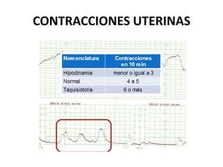 CONTRACCIONES UTERINAS
 