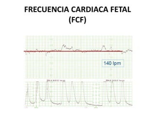 FRECUENCIA CARDIACA FETAL
(FCF)
 