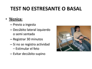 TEST NO ESTRESANTE O BASAL
• Técnica:
– Previo a ingesta
– Decúbito lateral izquierdo
o semi sentada
– Registrar 30 minutos
– Si no se registra actividad
– Estimular el feto
– Evitar decúbito supino
 