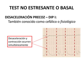 TEST NO ESTRESANTE O BASAL
DESACELERACIÓN PRECOZ – DIP I:
También conocido como cefálico o fisiológico
Desaceleración y
contracción ocurren
simultáneamente
 