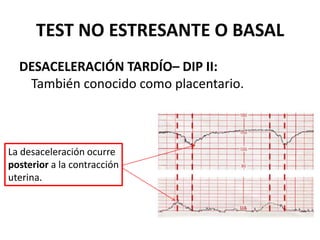 TEST NO ESTRESANTE O BASAL
DESACELERACIÓN TARDÍO– DIP II:
También conocido como placentario.
La desaceleración ocurre
posterior a la contracción
uterina.
 