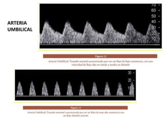 ARTERIA
UMBILICAL
 