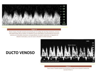 DUCTO VENOSO
 