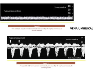 VENA UMBILICAL
 