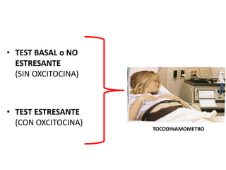 • TEST BASAL o NO
ESTRESANTE
(SIN OXCITOCINA)
• TEST ESTRESANTE
(CON OXCITOCINA)
TOCODINAMOMETRO
 