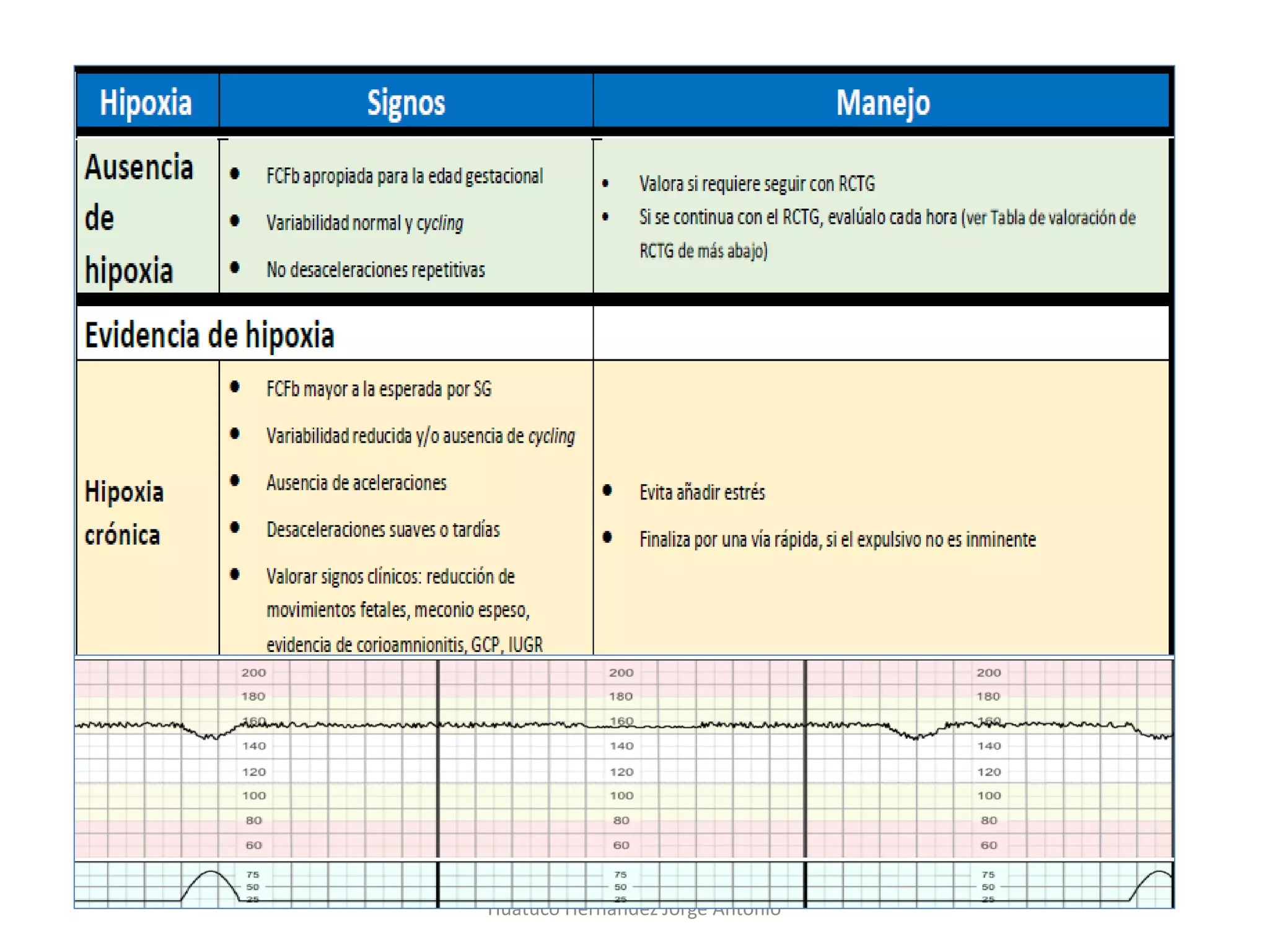 Vigilancia Fetal Intraparto Basada En La Fisiopatologia De La Hipoxia PDF vigilancia-fetal-intraparto-basada-en-la-fisiopatologia-de-la-hipoxia-pdf